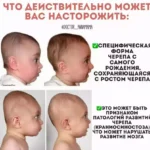 Какое значение имеют роднички на голове у ребенка?