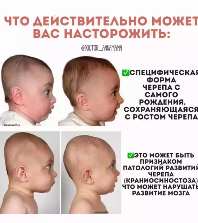 Какое значение имеют роднички на голове у ребенка?