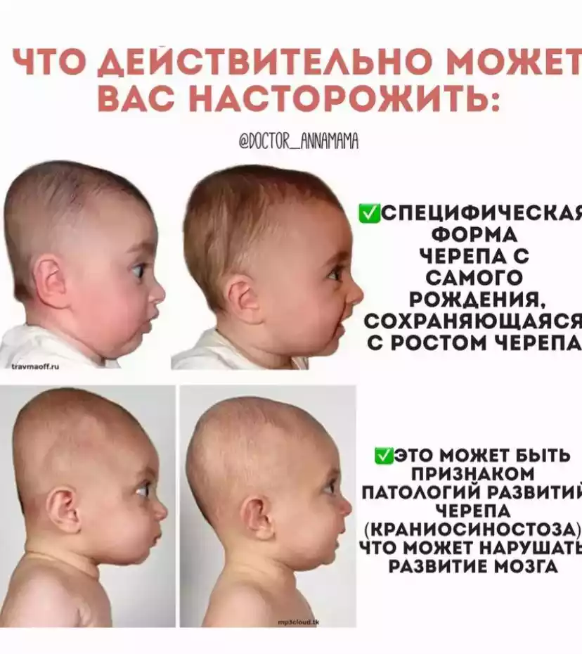 Какое значение имеют роднички на голове у ребенка?